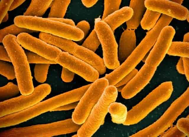 What is E.coli